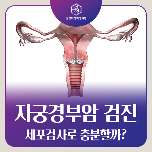 자궁경부암 세포검사, 결과만 믿어도 괜찮을까요?